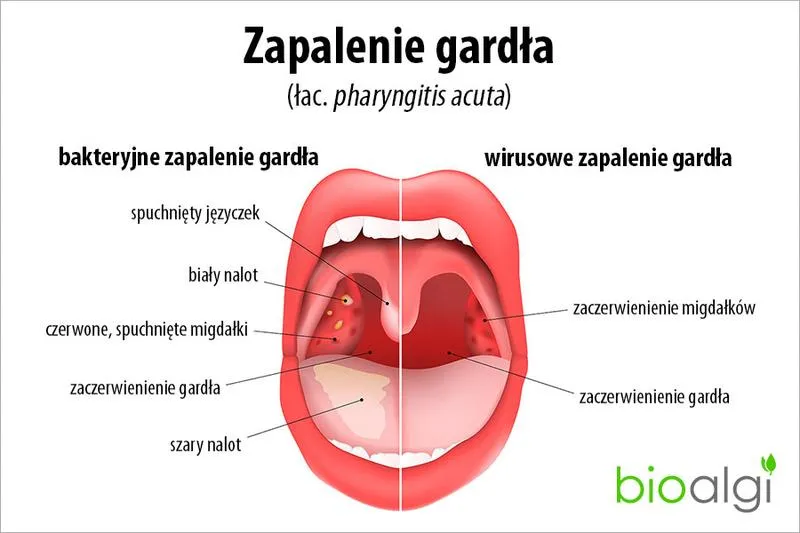 Czy możesz biegać, gdy dokucza ci ból gardła? Sprawdź, co mówią eksperci!