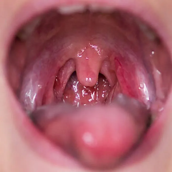 Biegając podczas choroby