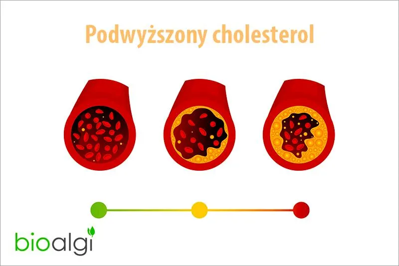 Bieganie i cholesterol