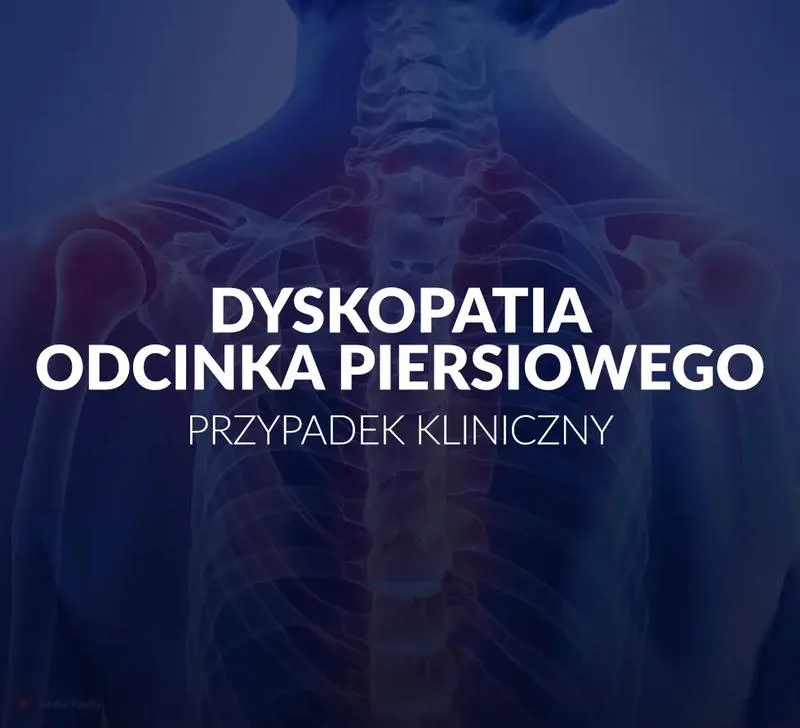 Bieganie przy dyskopatii