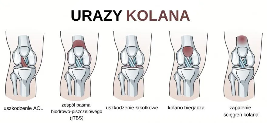 Ćwiczenia na wzmocnienie kolan