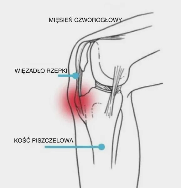 Fizjoterapia w leczeniu bólu
