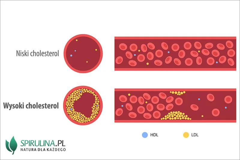 Zdrowy cholesterol